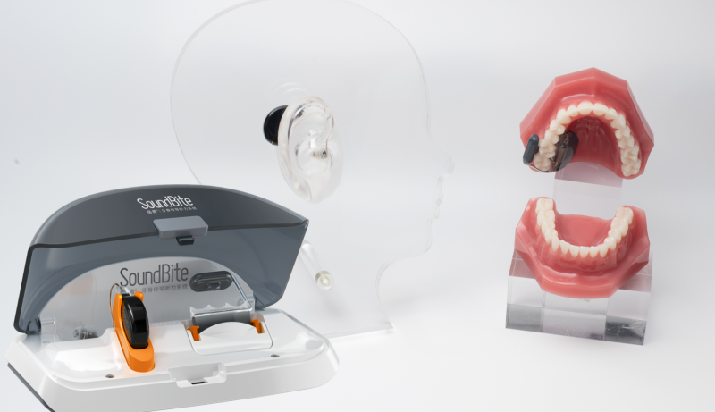 品音&reg;SoundBite&reg;牙骨傳導聽力系統(tǒng)-