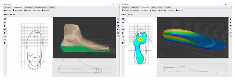 矯形鞋墊快速設(shè)計軟件-